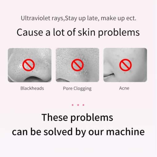 ANLAN Ultrasonic Skin Scrubber Deep Face Cleaning Machine Peeling Shovel Facial Pore Cleaner Face Skin Scrubber Lift Machine color: as picture|Pink|Green|White  New Arrivals Uncategorized Best Sellers