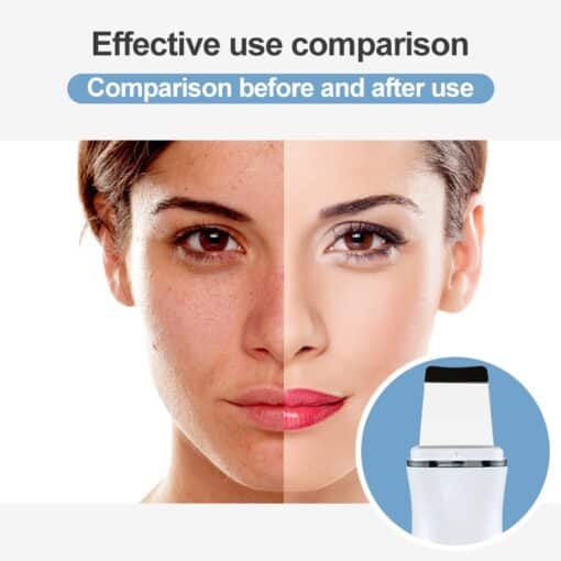AmazeFan Ultrasonic Skin Scrubber Peeling Shovel Ion Acne Blackhead Remover Deep Cleaning Machine face Lifting Facial Massager 1ef722433d607dd9d2b8b7: China|France|Poland|Russian Federation|SPAIN|United States  New Arrivals Uncategorized Skin Care Best Sellers