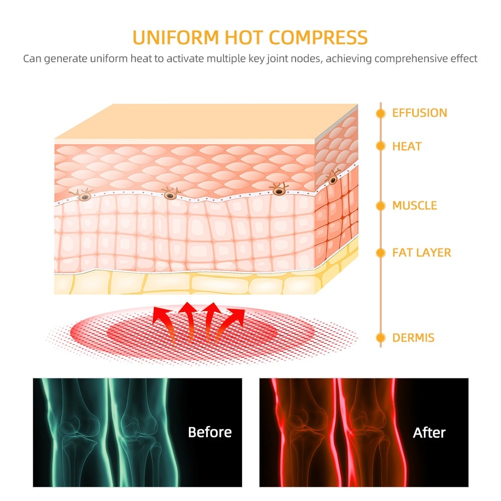 Smart Hot Compress Knee Relaxing Massager Kneecap Treasure Laser Infrared Elbow Shoulder Massager Relive Joint Pain Stiffness
