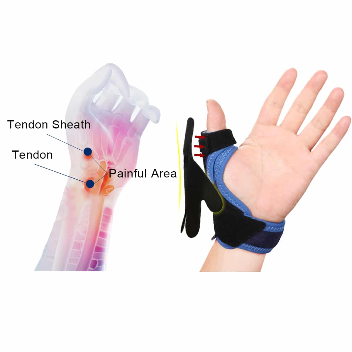 VELPEAU Tenosynovitis Thumb Protector for Mouse Hand Relieve Pain Thumb Brace Light Breathable Splint for Left and Right Hand