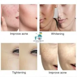 3-in-1 Skin Treatment LED Mask color: 3 Color-USB Recharge|7 Color-USB Recharge|Type-1 White|Type-2 Transparent|Type-3 Wireless  New Arrivals As Seen On TV Skin Care Safest LED Beauty Masks Best Sellers