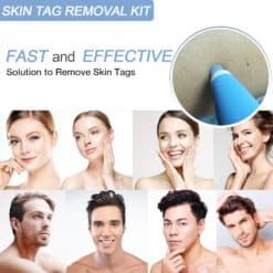 LESCOLTON Auto Skin Tag Remover Painless Mole Wart Remover Skin Tag Removal Kit with Cleansing Swabs Facial Beauty Tool Home Use color: 40 Bands|60 Bands|80 Bands  New Arrivals Uncategorized Skin Care Best Sellers