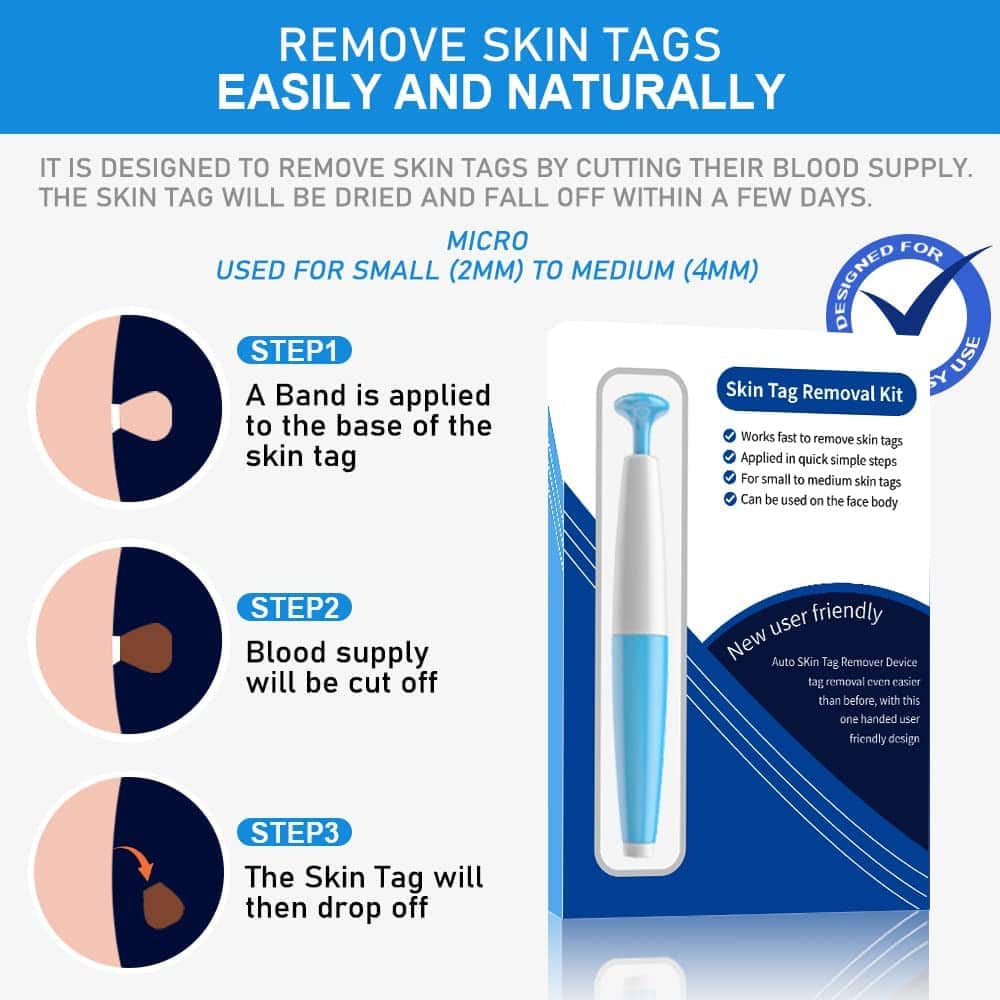 LESCOLTON Auto Skin Tag Remover Painless Mole Wart Remover Skin Tag Removal Kit with Cleansing Swabs Facial Beauty Tool Home Use