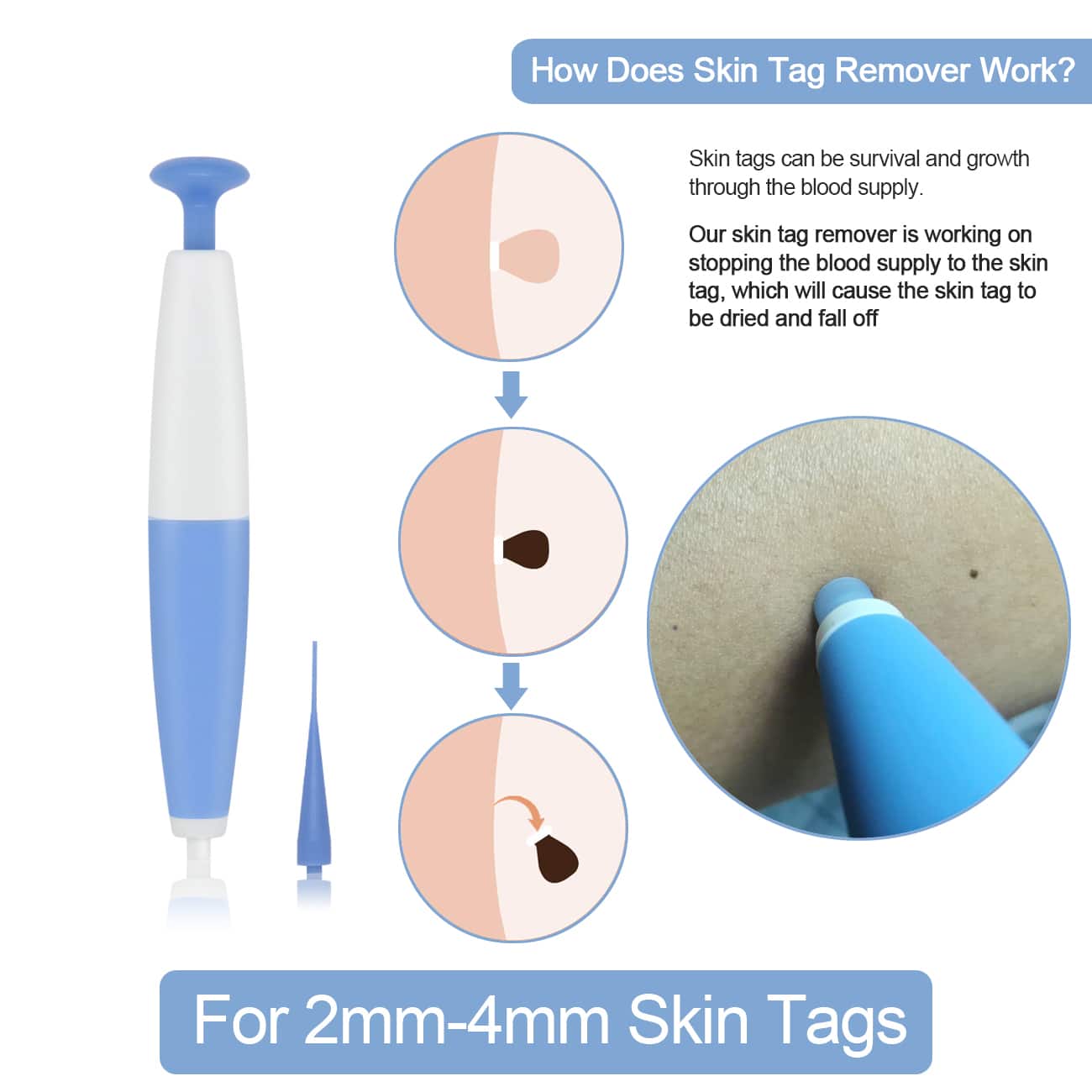 LESCOLTON Auto Skin Tag Remover Painless Mole Wart Remover Skin Tag Removal Kit with Cleansing Swabs Facial Beauty Tool Home Use